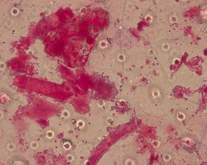 Melissococcus pluton White